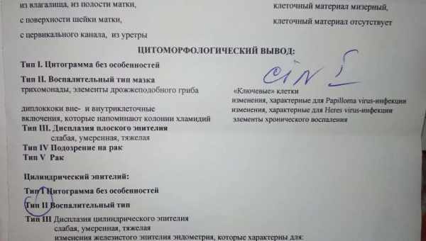 Воспаление цервикального канала — причины, симптомы, и лечение. Что будет, если воспаление цервикального канала не лечить?