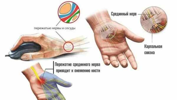 Рожистое воспаление руки: причины и симптомы. Лечение рожистого воспаления руки, необходимые анализы, диета, местные средства