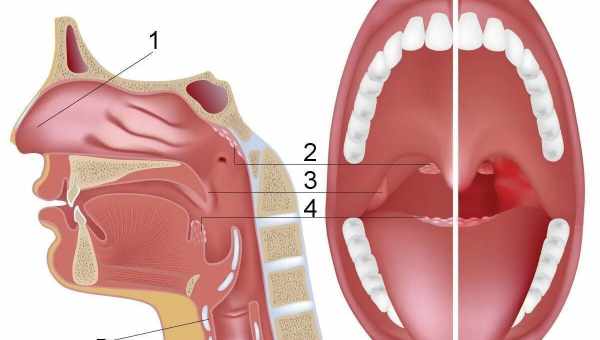 Воспаление носоглотки: причины, симптомы. Лечение воспаления носоглотки