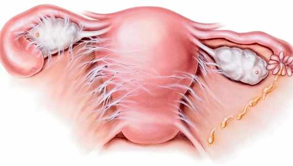 Хроническое воспаление придатков: причины и симптомы. Методы лечения хронического воспаления придатков